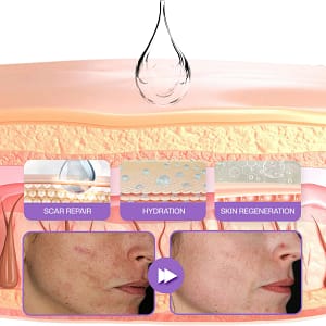 ATTDX® RevivaDerma Face & Body Scar Gel