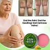 VeinBalm™ | Varicose Vein Ointment | Reduce Varicose Veins by 95% in 7 Days