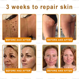 Daasry® Botox Bee Venom Skin Restoration Cream