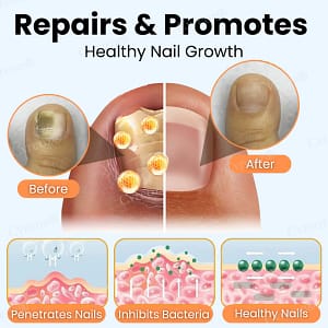 Cvreoz® Nail Strengthening Ointment