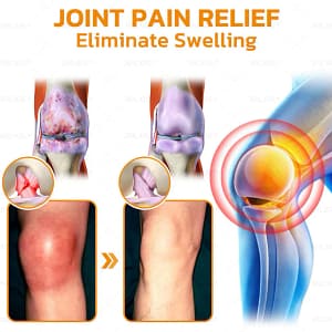 ZVLZVL® Bee Venom Pain-Relief Bone Healing Cream 