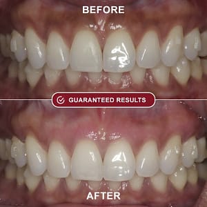 Don't let gum problems control your life any longer! Get relief in just 5 minutes a day!