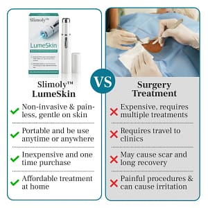 Slimoly™ LumeSkin Mole and Wart Removal Laser Pen 