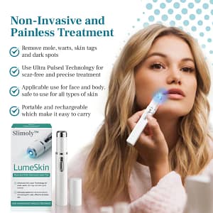 Slimoly™ LumeSkin Mole and Wart Removal Laser Pen 