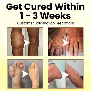Cvreoz® Magnesium Oil & Bee Venom Joint Healing Spray