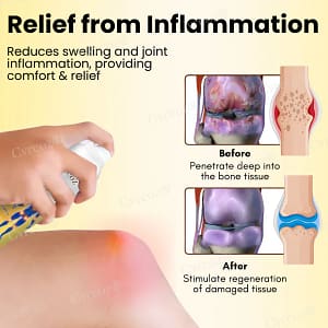 Cvreoz® Magnesium Oil & Bee VenoCvreoz® Magnesium Oil & Bee Venom Joint Healing Spraym Joint Healing Spray