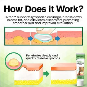 Cvreoz® Herbal Lymphatic Detox Cream