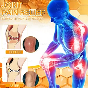 ZVLZVL® Bee Venom Pain-Relief Bone Healing Cream 