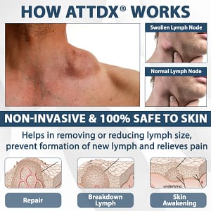ATTDX® EdemaEase Black Cumin Therapy Cream