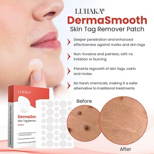 Luhaka® DermaSmooth Skin Tag Remover Patch