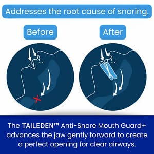 TAILEDEN™ Anti-Snore Mouth Guard+