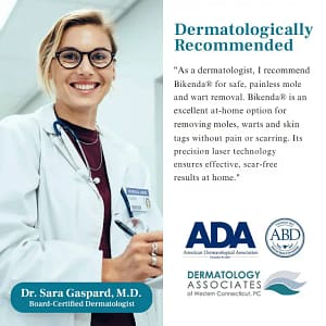 Bikenda® LumeSkin Mole and Wart Removal Laser Pen