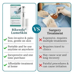 Bikenda® LumeSkin Mole and Wart Removal Laser Pen