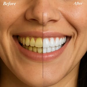 PureLush Teeth Whitening Powder