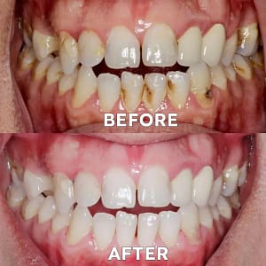 Ourlyard® Tooth Health Mineral Powder