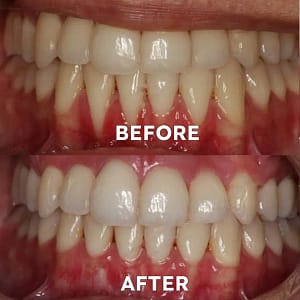 Ourlyard® Tooth Health Mineral Powder