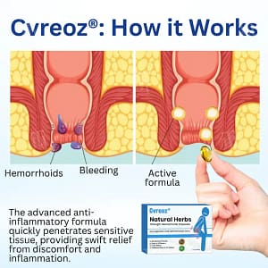 Cvreoz® Natural Herbs Strength Hemorrhoids Capsules