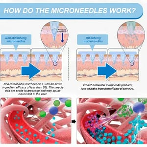 Croaie® GLP-1 Nano-Microneedle Patch with Collagen
