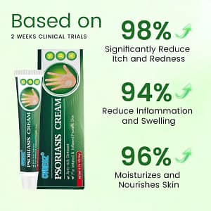 Cvreoz® Knotaway Psoriasis Cream