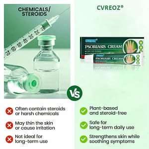 Cvreoz® Knotaway Psoriasis Cream