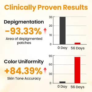 Timilk® VitiGone Rapid Spray — 2–3 Week Repigmentation with OTDS