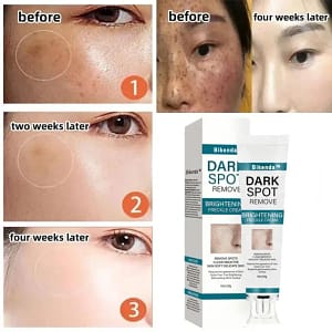 Bikenda™️ Blemish Removing Beauty Cream