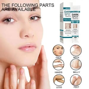 Bikenda™️ Blemish Removing Beauty Cream