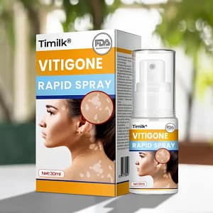 Timilk® VitiGone Rapid Spray — 2–3 Week Repigmentation with OTDS