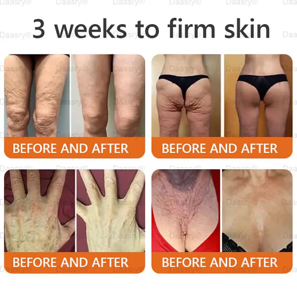 Daasry® Botox Bee Venom Skin Restoration Cream