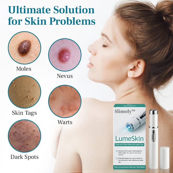 Slimoly™ LumeSkin Mole and Wart Removal Laser Pen 