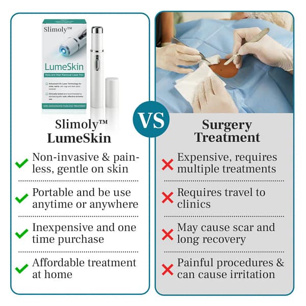 Slimoly™ LumeSkin Mole and Wart Removal Laser Pen 