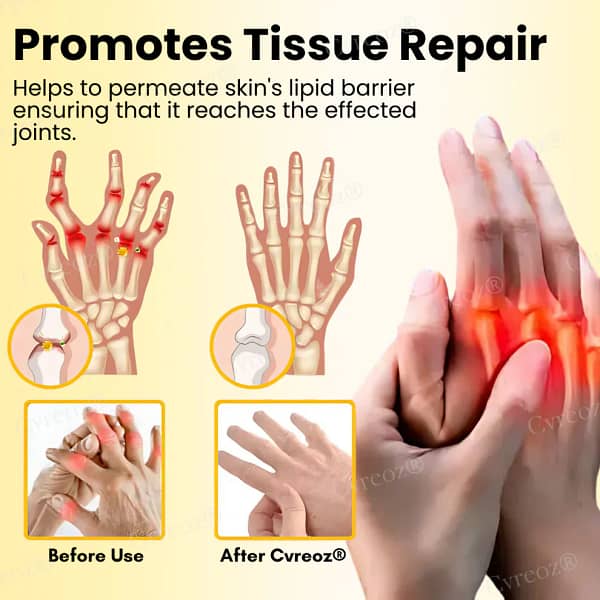 Cvreoz® Magnesium Oil & Bee Venom Joint Healing Spray