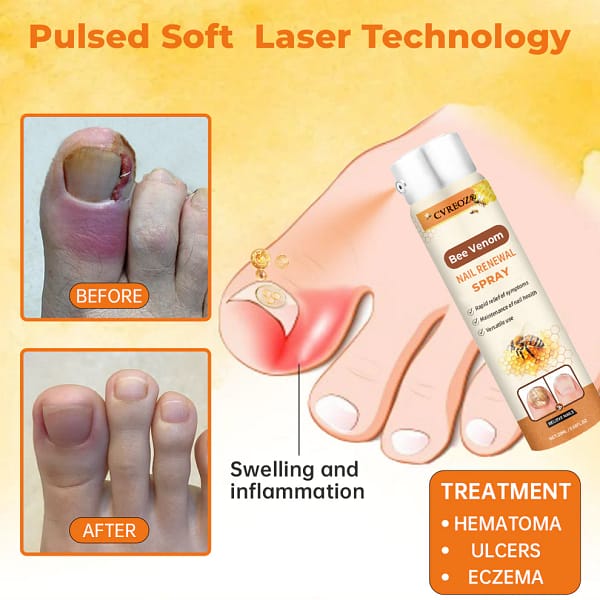 Cvreoz®Bee Venom Nail Renewal Spray