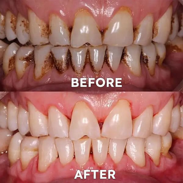 Ourlyard® Tooth Health Mineral Powder