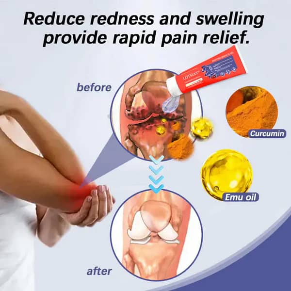LOTMAY® Turmeric & Emu Oil Arthritis Soothing Pain Relief Massage Gel
