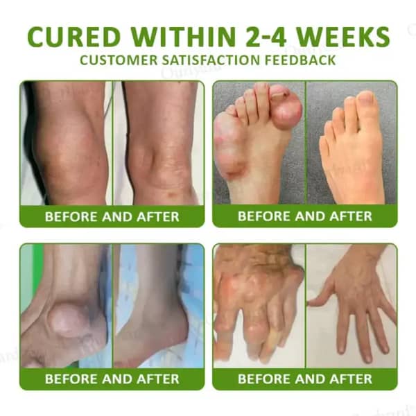 NovaRX® Magnesium & Peppermint Arthritis Pain Relief and Bone Healing Cream