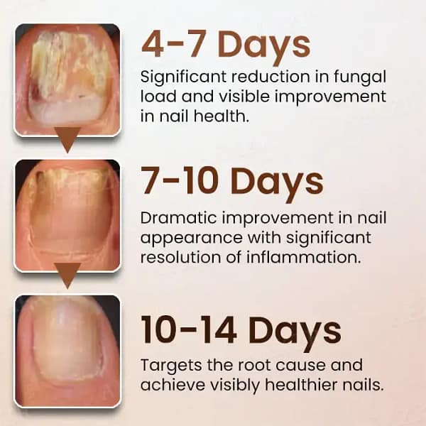 Piguiay® Nails Repairing Serum