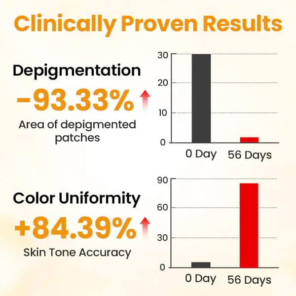 Timilk® VitiGone Rapid Spray — 2–3 Week Repigmentation with OTDS