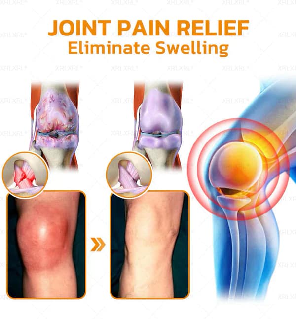 ZVLZVL® Bee Venom Pain-Relief Bone Healing Cream 