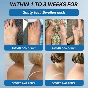 flysmus®️ BPC-157 Joint Healing Cream