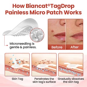 Biancat® TagDrop Painless Micro Patch