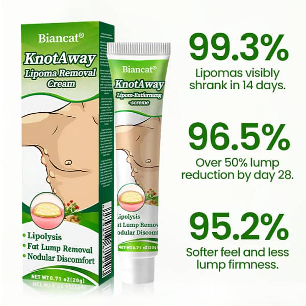 Biancat® KnotAway Lipoma Removal Cream