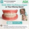 SmileCraft™ Custom-Fit Functional Dentures