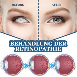Lovilds™ Myopia Reversal Eye Drops
