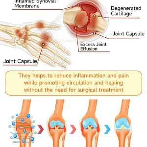 AQA™ Botulinum and Bee Toxin Pain Relief Bone Healing Cream