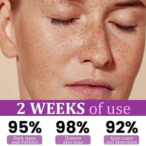 Juxek® MelantraX Advanced Anti-Hyperpigmentation Essence