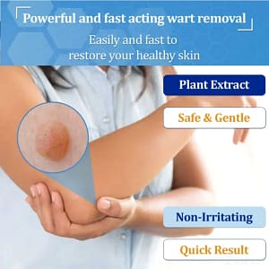 Zvoevo® BeeDerm RX Cream, Painless, Targeted Treatment for Warts