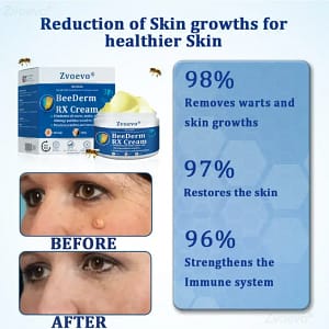 Zvoevo® BeeDerm RX Cream, Painless, Targeted Treatment for Warts