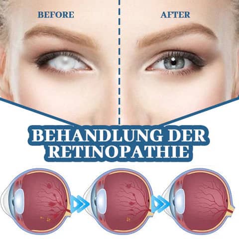 Lovilds™ Myopia Reversal Eye Drops