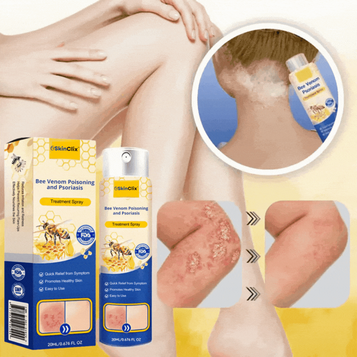 SkinClix™ | Effectively relieves itching and flaking